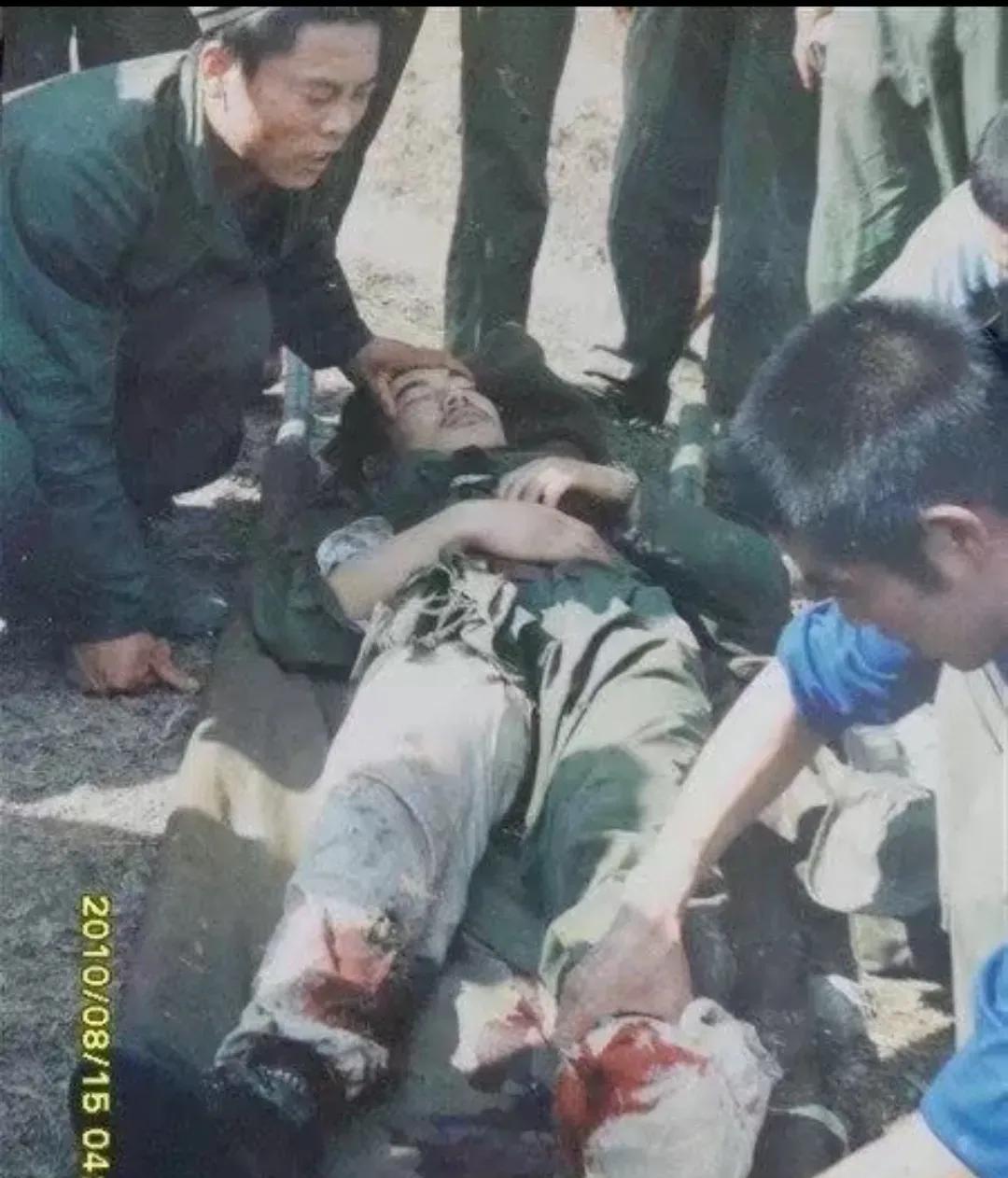 这是1988年，副连长张建刚在老山前线率部执行侦查抓俘任务时，不幸被越军重型手雷