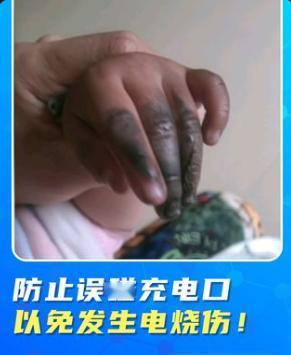 河北邯郸俩孩子用金属钥匙插进电瓶车充电口，瞬间漏电发生爆炸，大人拿拖鞋拍开钥匙时