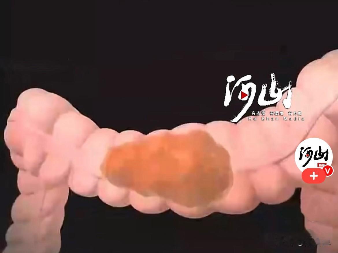 真是豁出去了……近日，北京一位李女士，为了追求所谓的水嫩亮肤、全身排毒，听信美