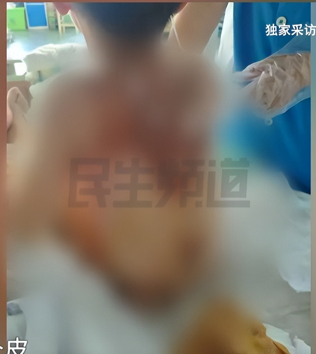 “还敢给婆婆带孩子吗？”河南漯河，奶奶给孙子洗澡，放完热水时离开，没想到4岁孙子