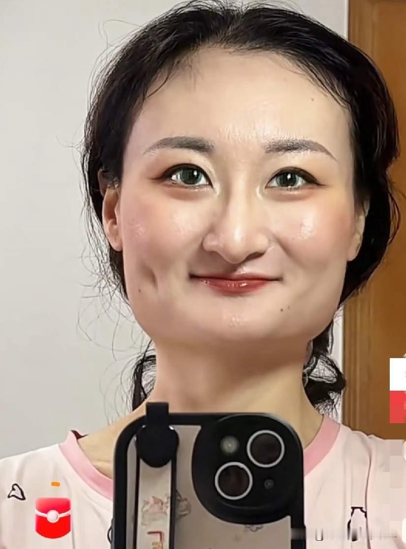 虽然我不建议女人们去做医美，但是真心建议这位女士去做下医美，因为这位女士的眼睛，