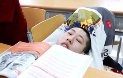 奇迹！山东德州，16岁的姜延琛脑袋长在屁股上，这位“折叠男孩”被医生宣判“死刑”