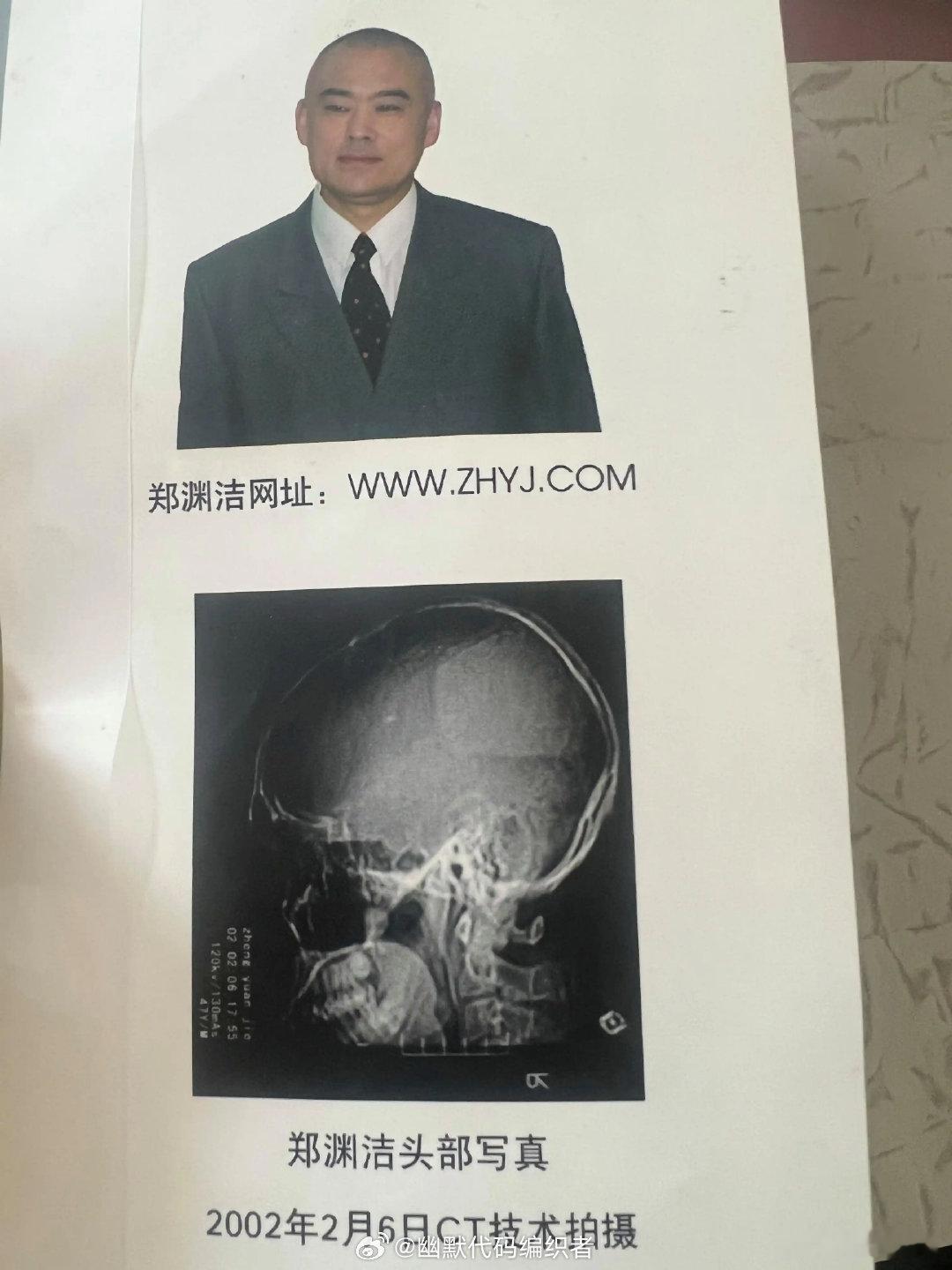 卧槽我真的笑死了​（​​​
