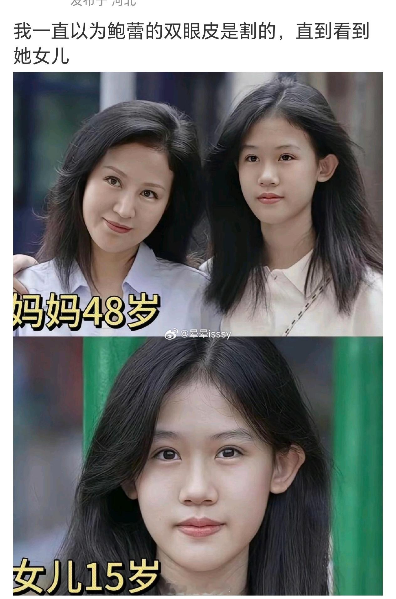 不过我看评论里说贝尔双眼皮也是割的