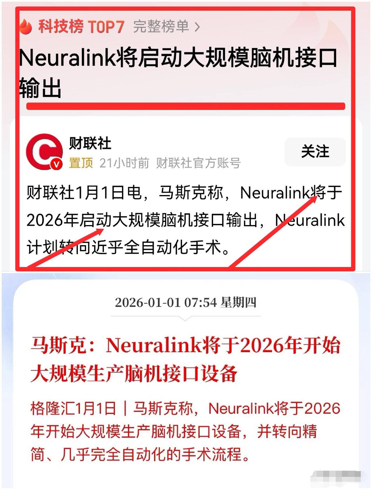 脑子插线，意念控制！马斯克这波玩真的，2026年要给万人“开颅”？早上刷手机