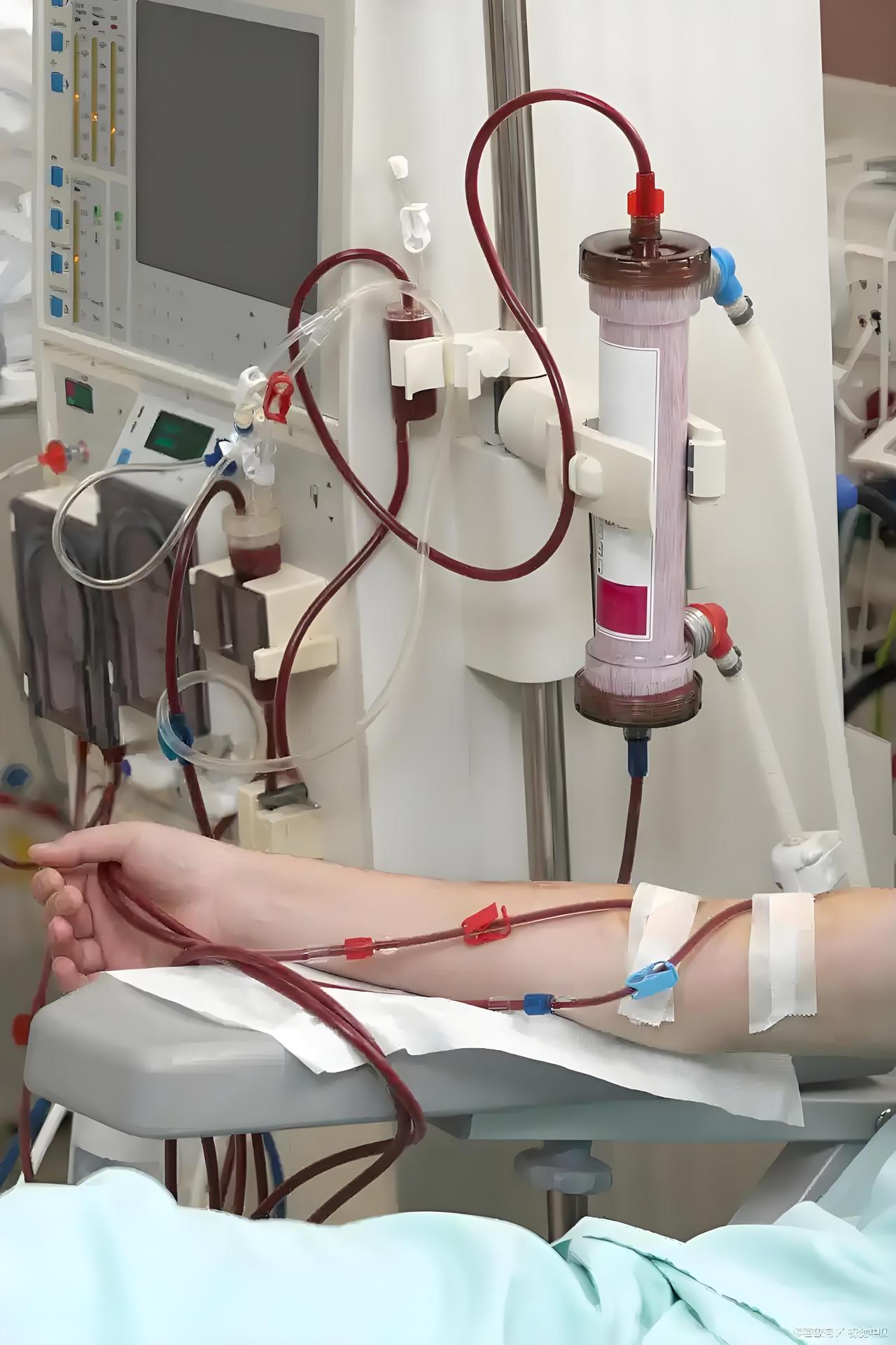 我一个当医生的叔叔跟我说了一个案例，让我再也不敢喝饮料了。他说，他们医院来了