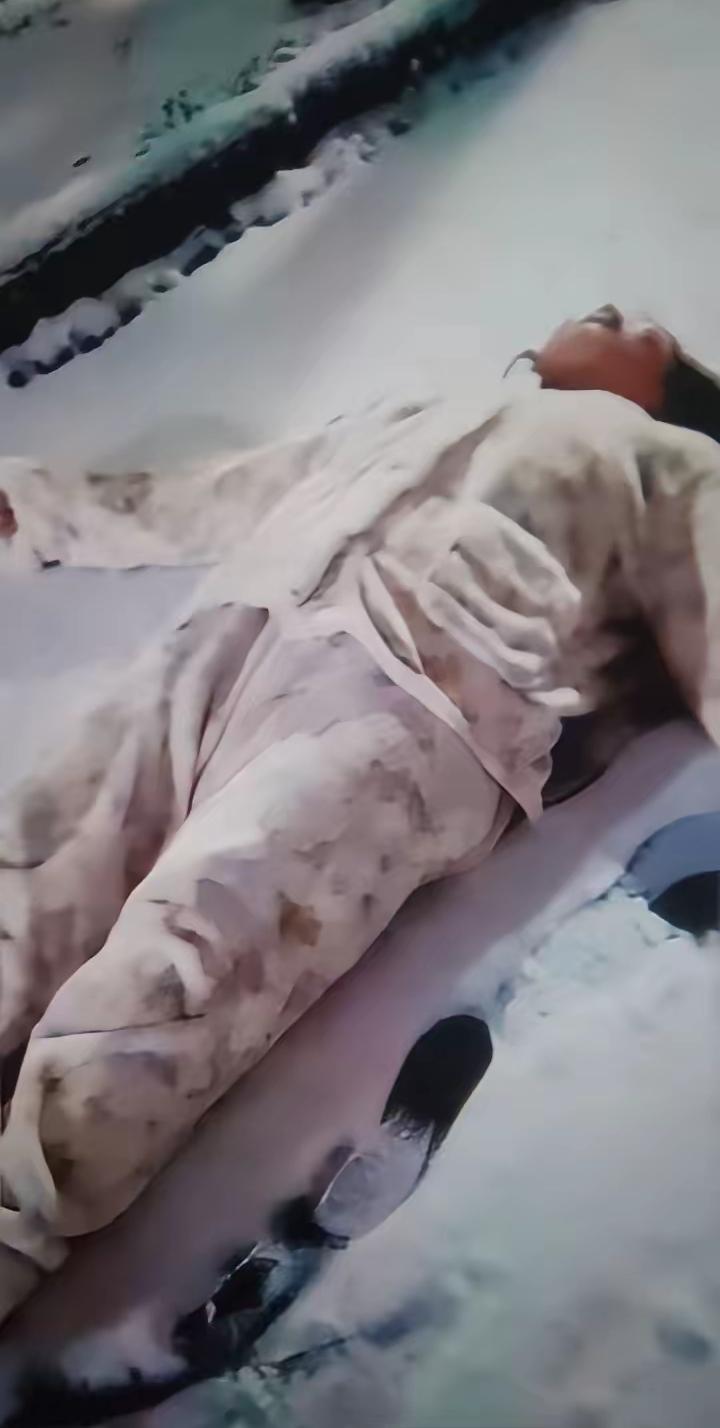 痛心！太快了，妻子下雪出去溜达玩，谁想到刚出门没一会儿就摔了，后脑勺直接磕在冰面