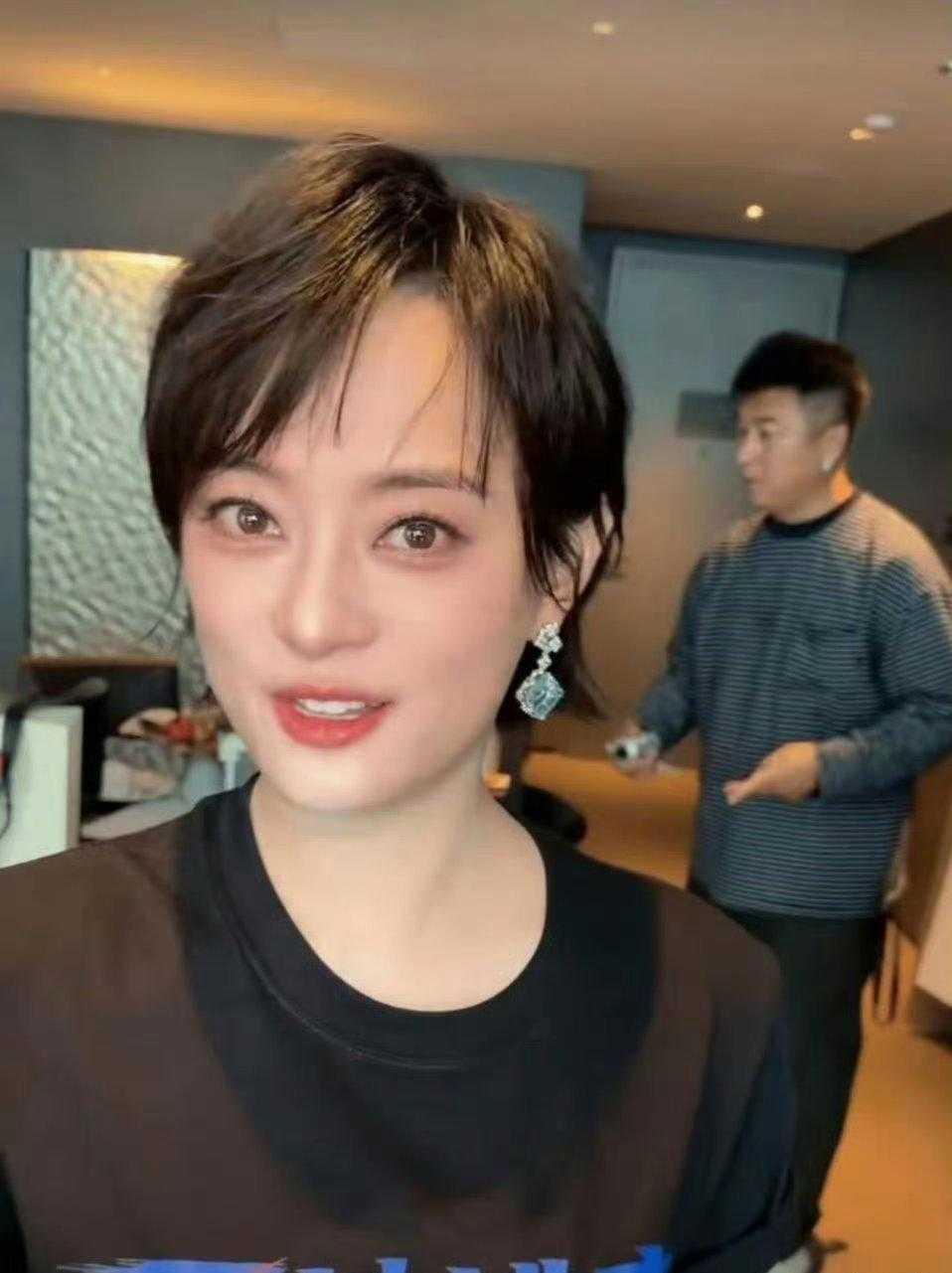 孙俪医美了吧，她眼睛不凸了，下巴的囊袋没了，更美了