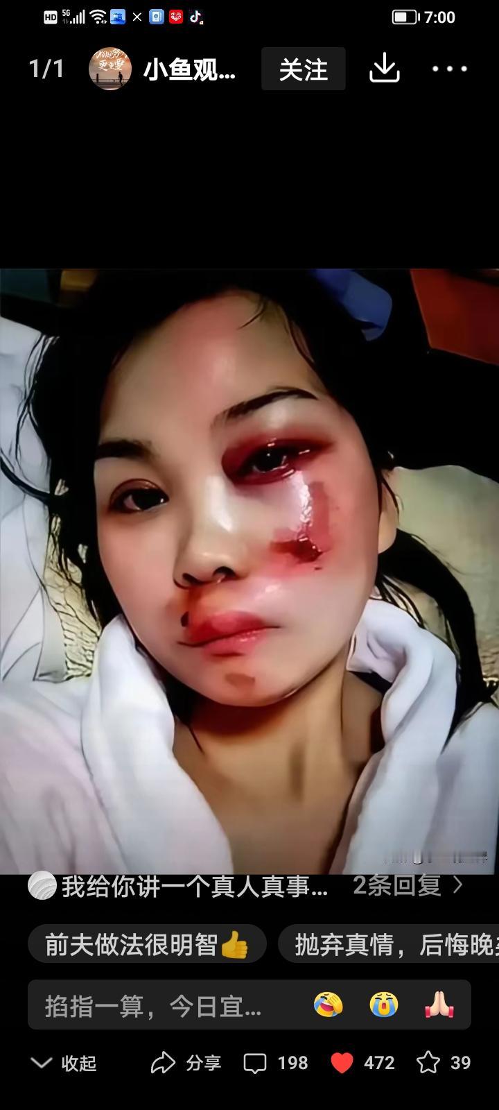 襄阳的刘女士这回算是彻底栽了。躺在医院里哼哼的时候，不知道她脑子里想的是现在的豪