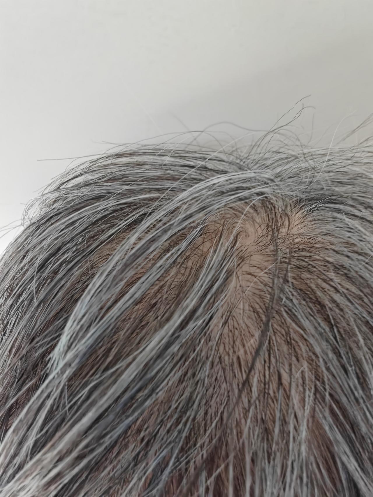 82岁的一位母亲，从摔倒后，一下子变得小心翼翼，小心地讨好着儿子。她一直得能