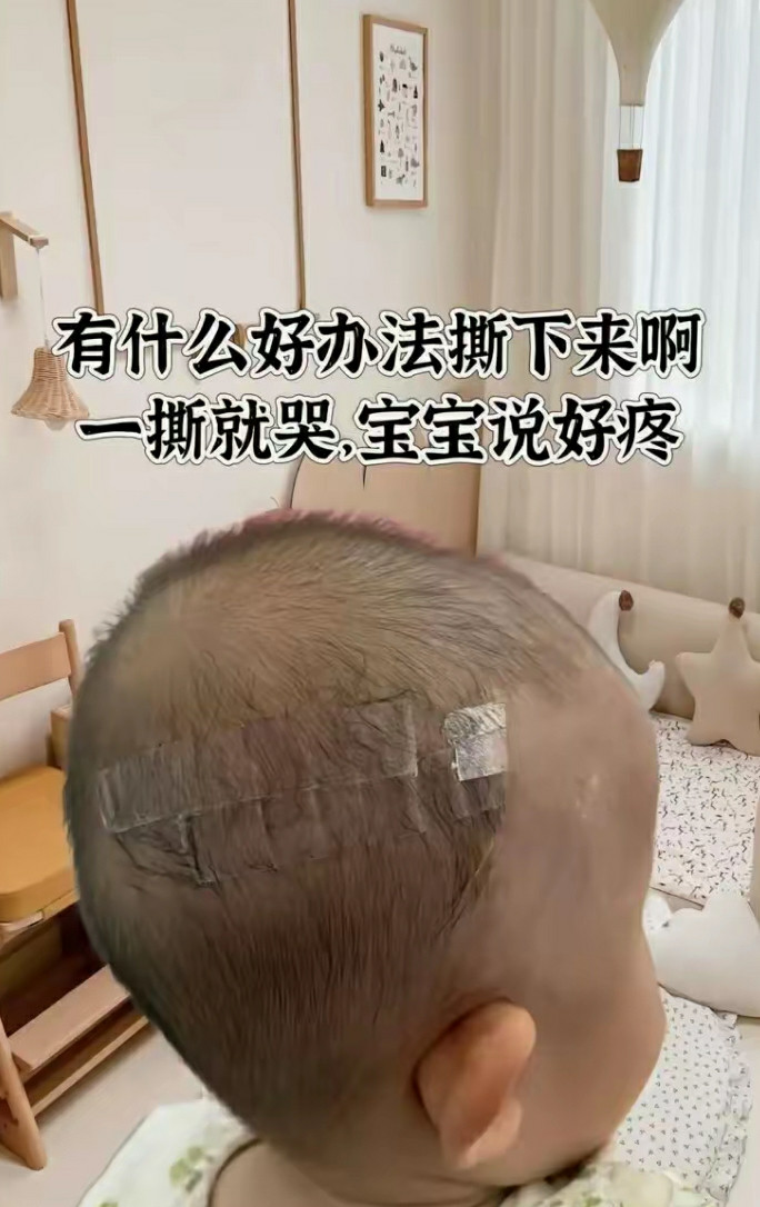 用胶带粘住嘴再揭就没有哭声了