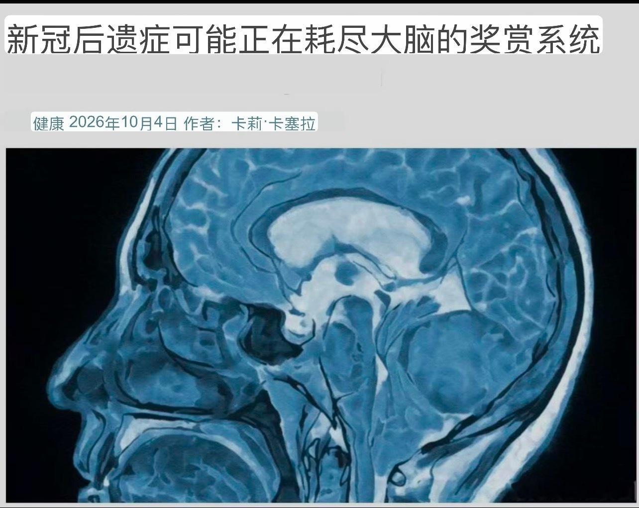 #抑郁症#⚠️⚠️26.10.4，著名医学期刊《eBioMedicine》（柳叶刀旗下子刊)最新的研