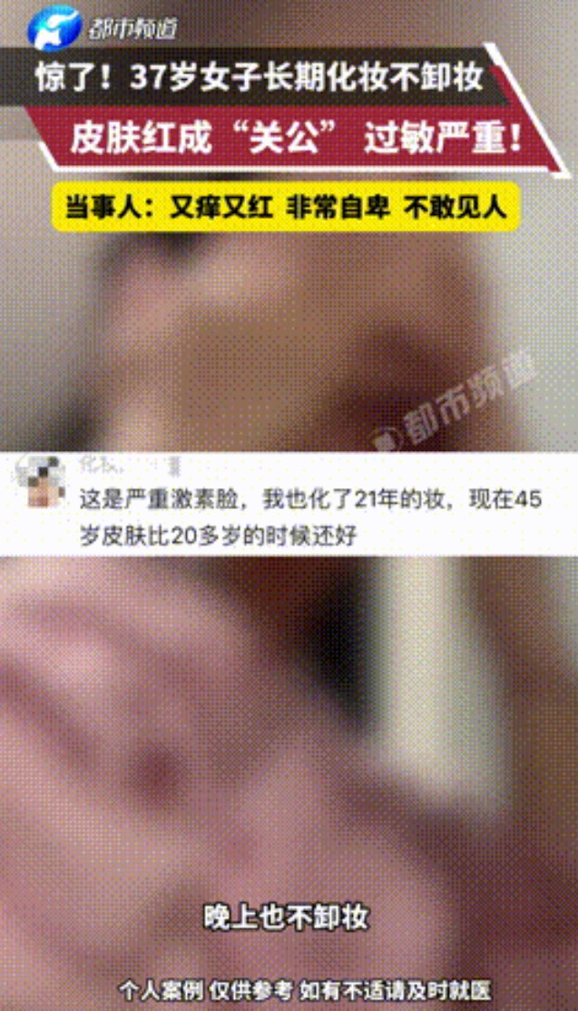 “太奇葩了！”吉林，37岁女子脸红成“关公”，只因15岁开始沉迷化妆，此后22年
