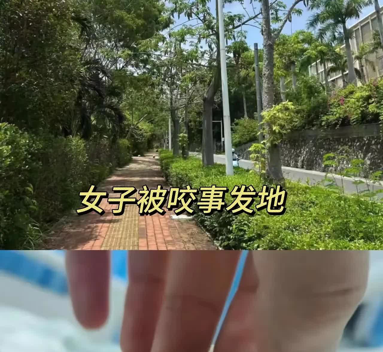 三亚被咬女子又被扒了这几个重要细节:1.该女子，是走在绿化带上面被咬的，旁边