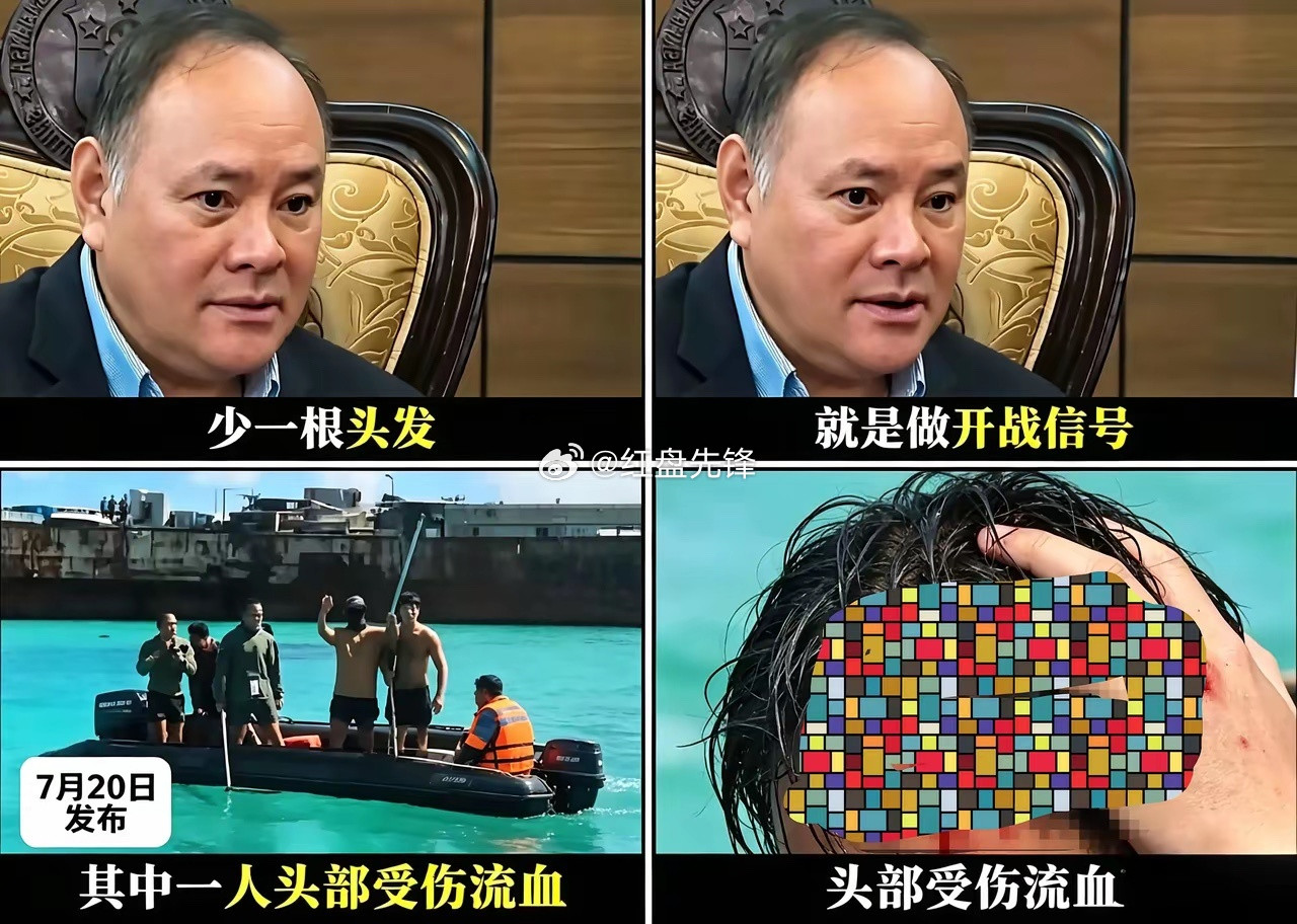 菲防长说：我仔细数了数，虽流了点血，但头发一根没少，所以还没到开战的条件！