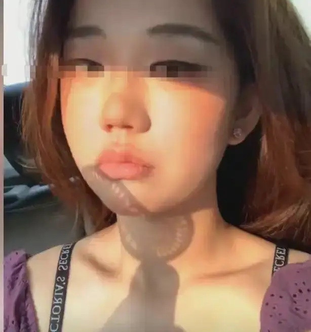 长沙摸臀事件的女主角，从她的一系列行为来看，可能存在偏执型人格障碍的问题。这种病