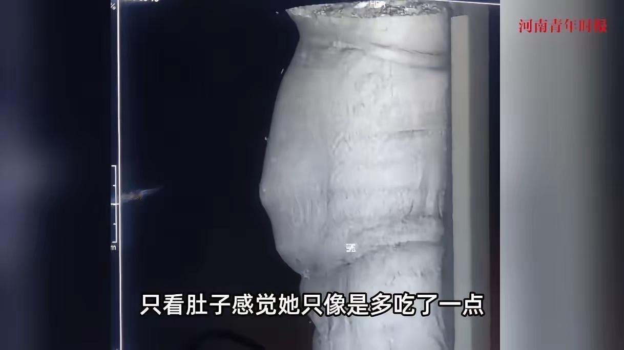 “离了个大谱！”2025年9月，一19岁女孩因为肚子疼到医院里就诊，期间医生反复