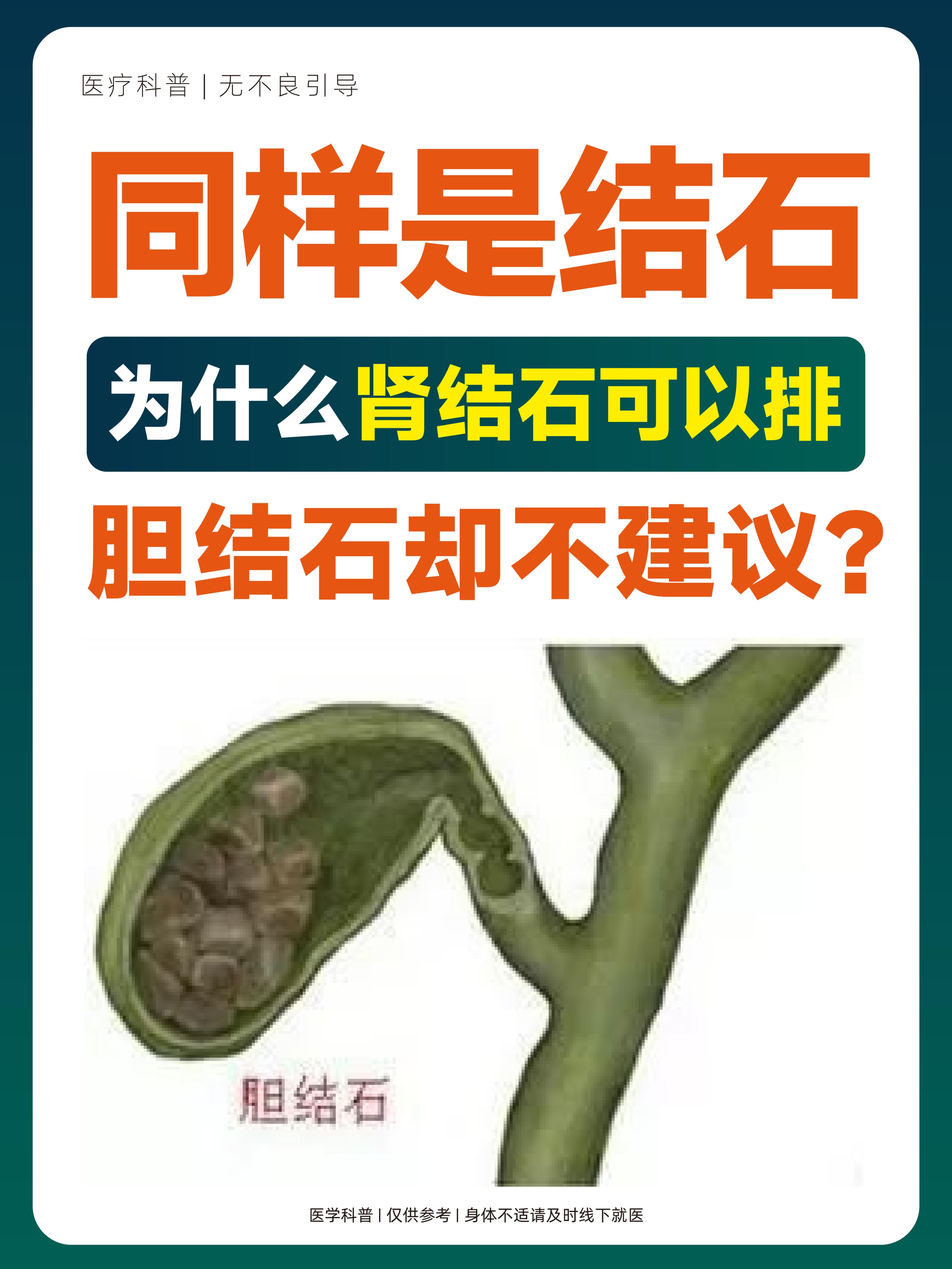 同样是结石为什么胆结石不可以保胆取石