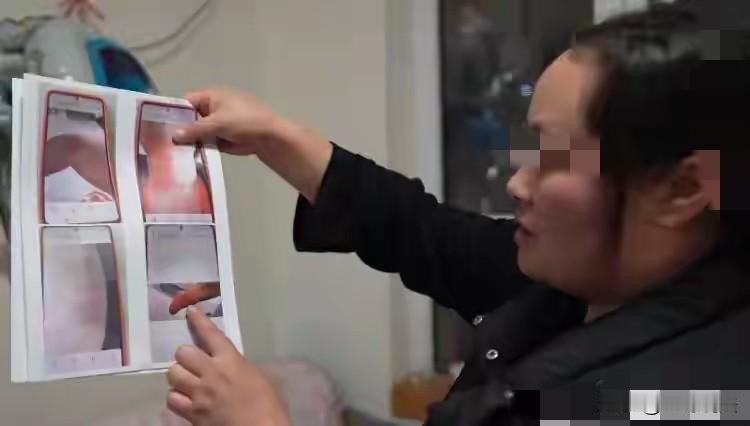 恶魔在世！湖北恩施，一39岁女子，被丈夫打13年，丈夫放出狠话，不会一次打死她，