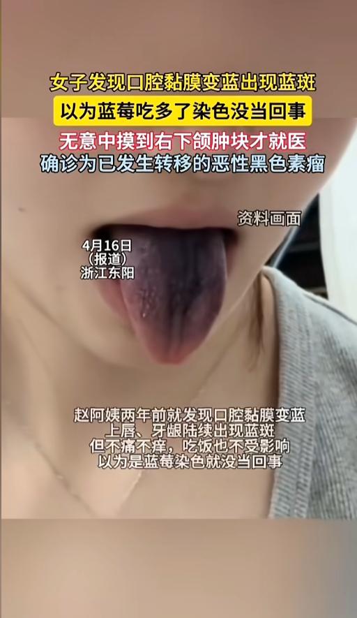 “整整耽误了两年啊！”浙江东阳，一女子发现自己的舌头变蓝了，牙龈也有些蓝色斑点，