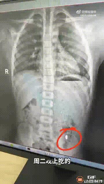 江苏苏州昆山一名女子网购了一颗重10克的金豆,拆完快递后就随手放在桌上,谁料被她