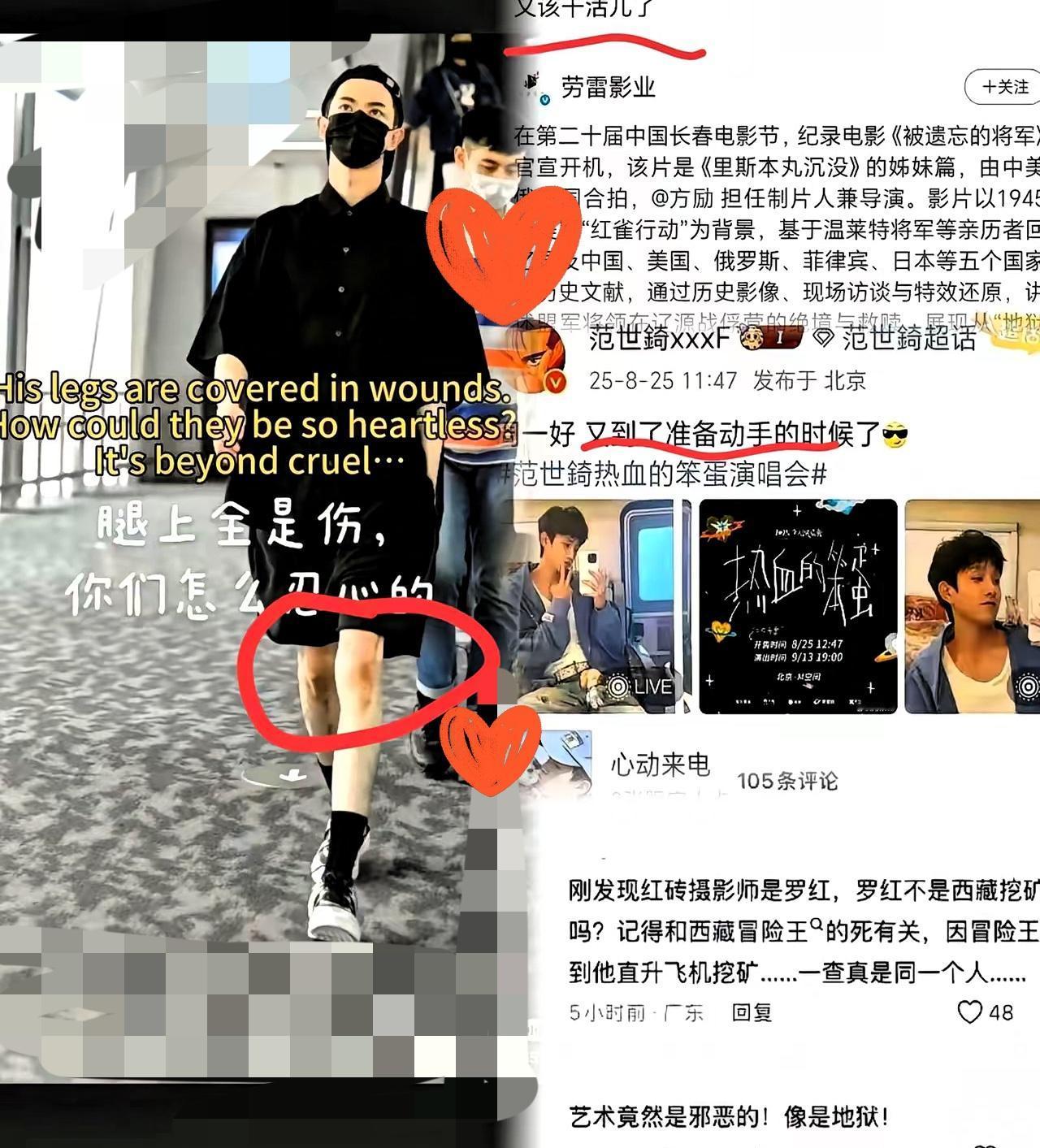 反复看那张照片，腿上的淤青看得人心里发紧！反复放大那张照片，屏幕里的淤青都透