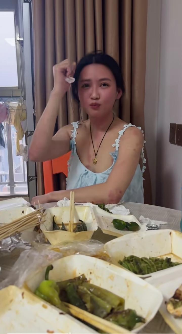 过敏了，怎么办？