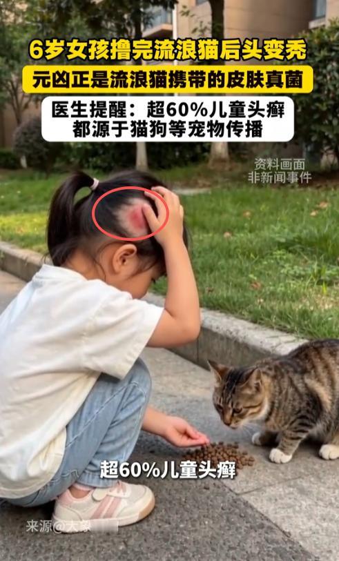 太揪心了！河南，一名6岁小女孩路边摸完流浪猫后，头顶疯狂长红疹、脱屑不止，头