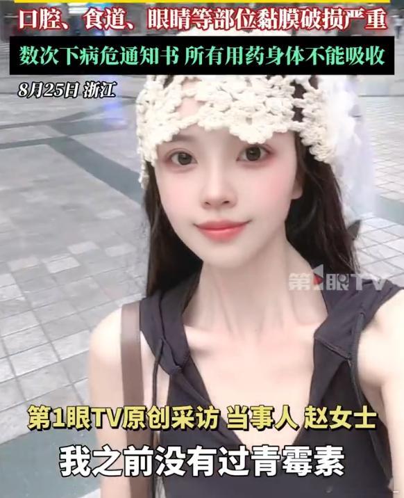 女子因头孢过敏全身皮肤大面破损我朋友打过几次头孢都没问题，但是最近一次挂水皮试