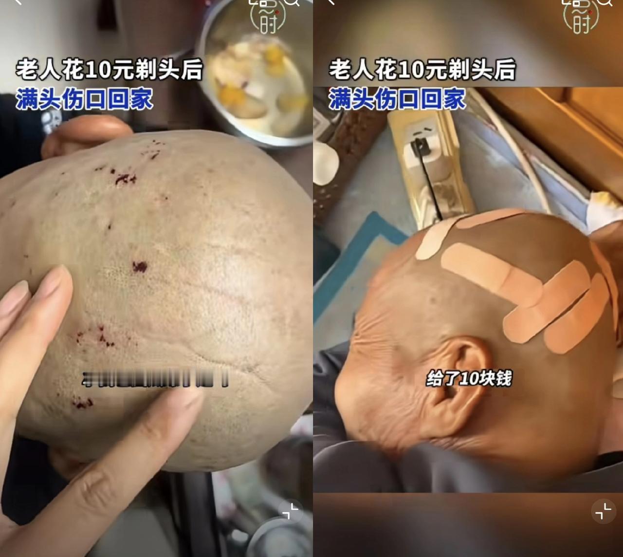 可别不当回事，万一染上病就坏了！天津一位老人，在路边花10块钱理发，结果