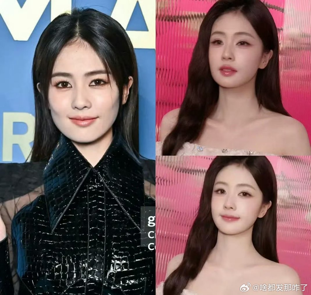 滤镜进步了还是医美做多了～