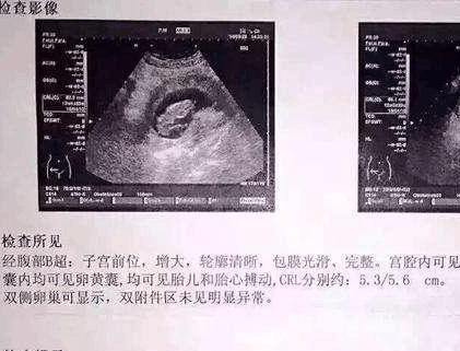 医院产下双胞胎男宝宝, 婆媳俩开怀大笑, 笑言中了个好彩头