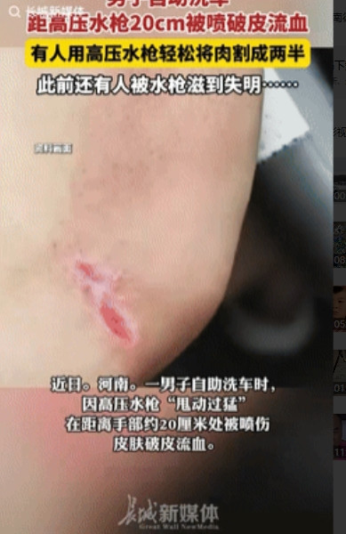 防不胜防！”河南，男子去自助洗车，不料一不小心水枪甩的有点猛，手部离枪有20来厘