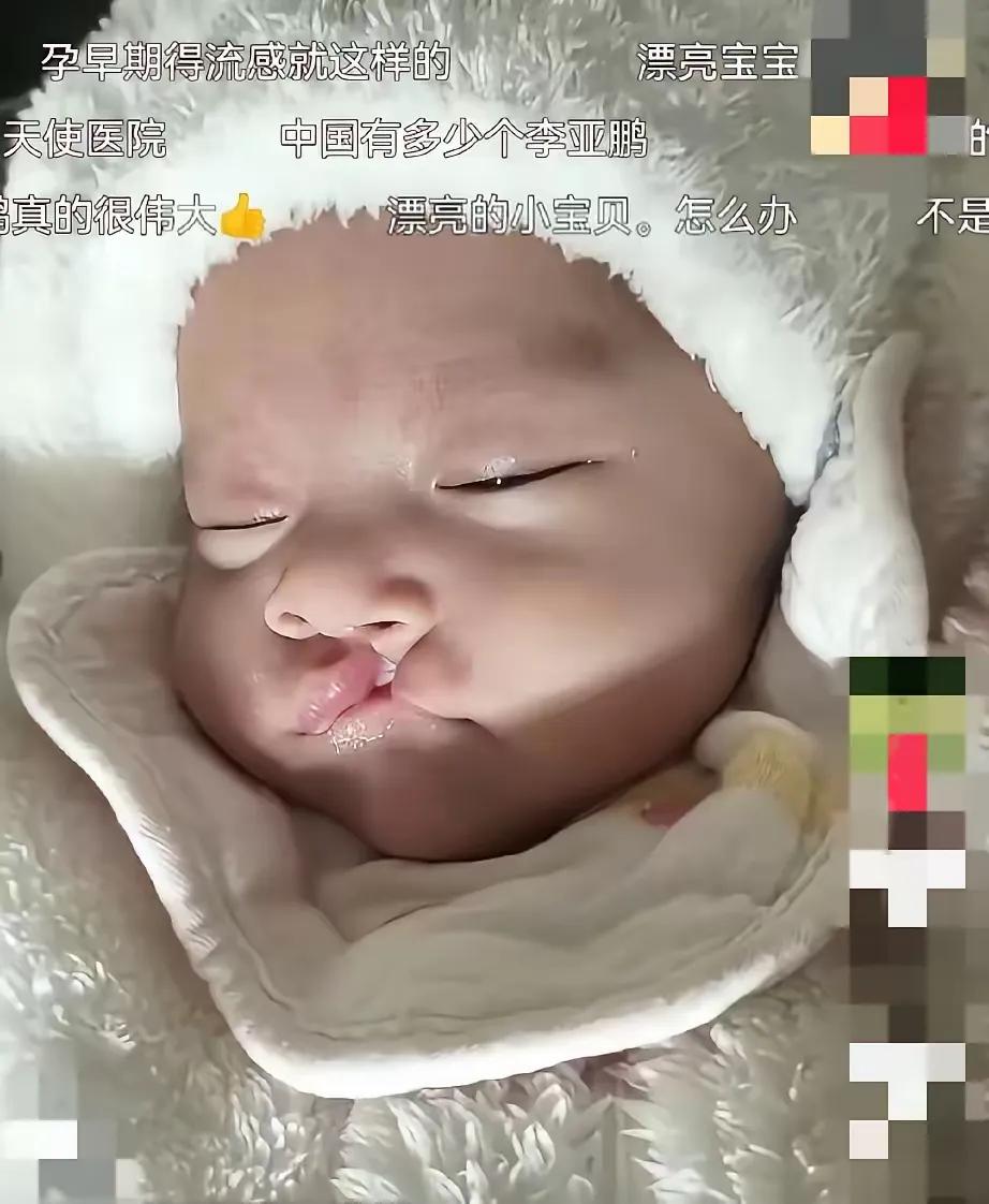 被暖到了！李亚鹏看到个唇裂幼童的视频，直接在下方留言：我们会联系你。再没有一句多