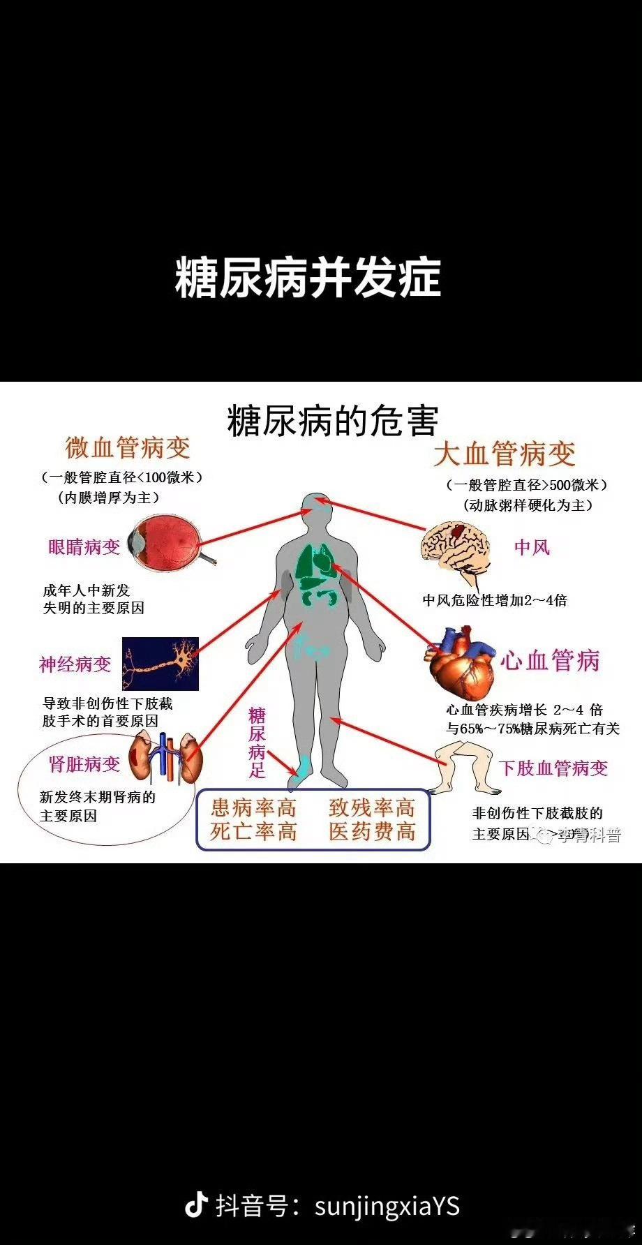 糖尿病年轻化糖尿病、痛风这些情况现在越来越年轻化了，还是得健康饮食，多锻炼吧！