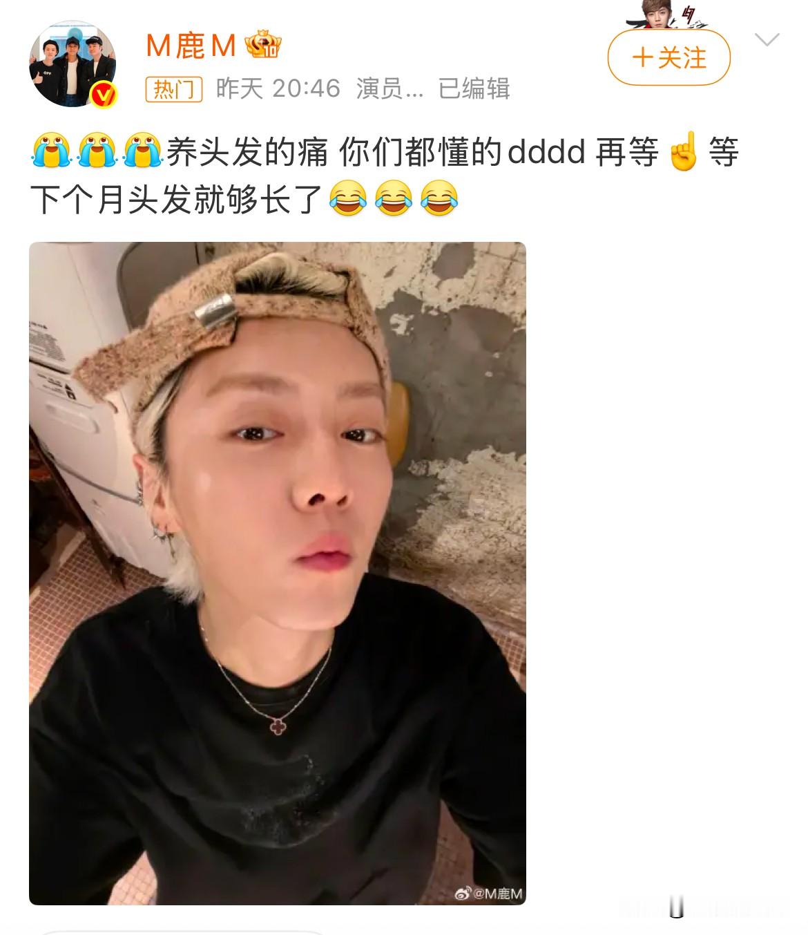 鹿晗状态变化让人感慨，也再次印证下颌缺少骨量，衰老来得格外明显，直播镜头下不少人直呼快认不出。面对网