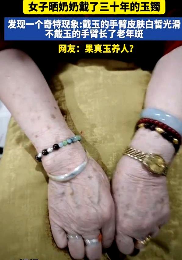 这下解释不清了！云南一女孩回家闲聊，惊见奶奶戴了三十年玉镯的那只胳膊光滑几乎无