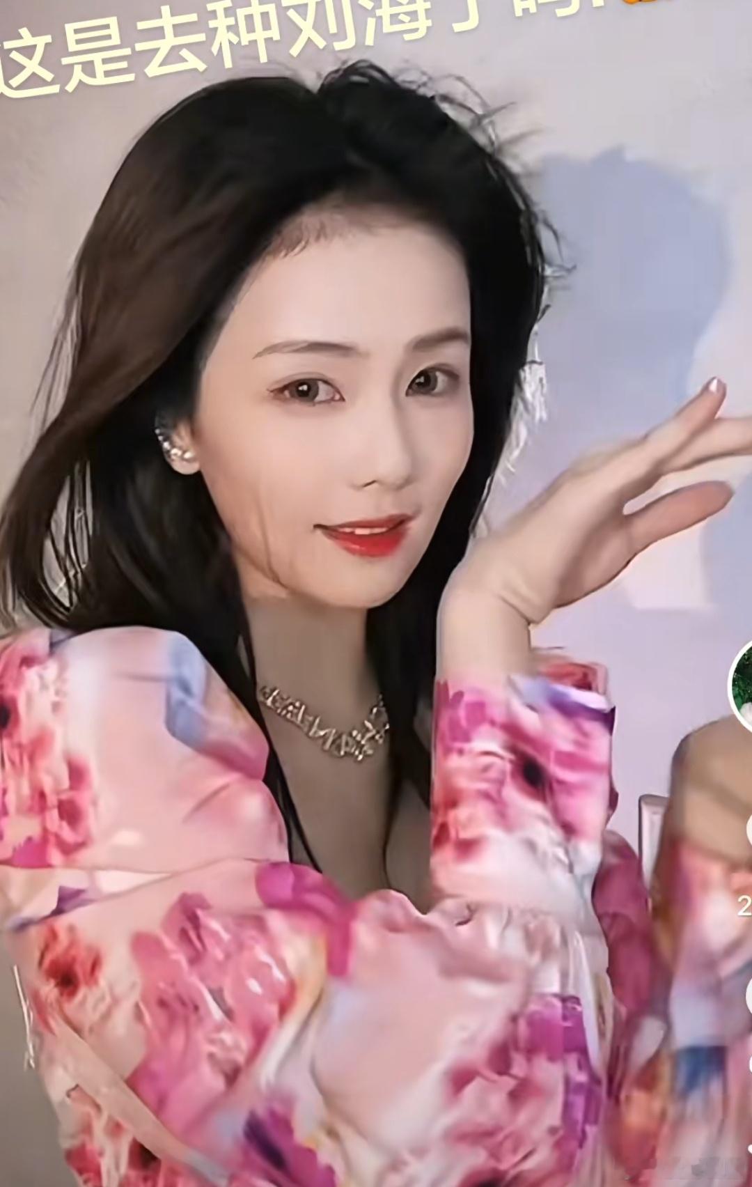 白鹿应该是植过发际线吧，早期这大脑门真是。。。