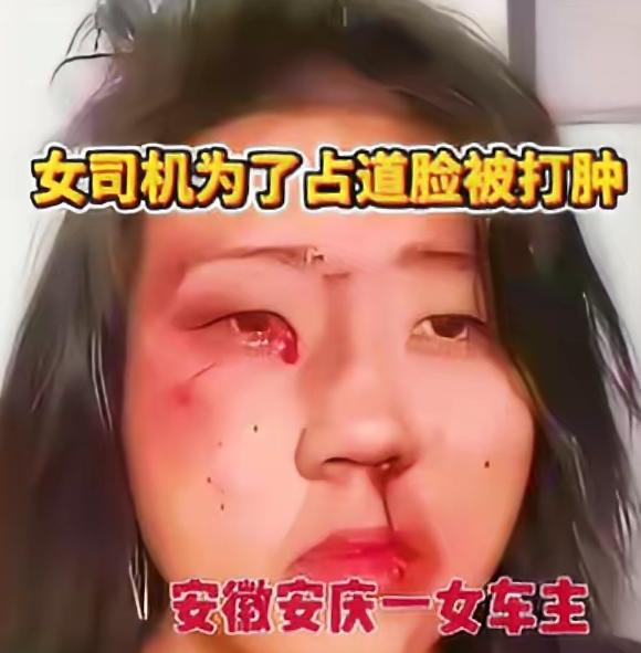 后面堵了8公里，前面有一位开着25码的慢车司机。慢车司机一边开车一边打视频电话，