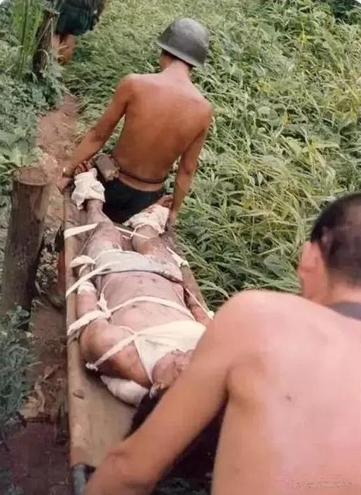 这是当年老山前线的照片，一名勇士负伤了，两名军工兵抬着他到后方医院治疗。炎热潮