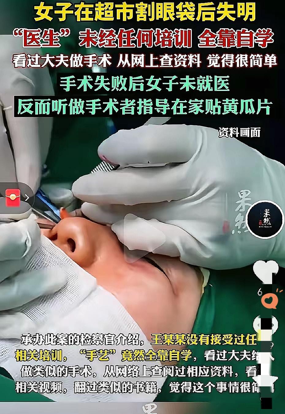“意外还是发生了”。一个女子想割眼袋，不去正规医院，不找专业医生，偏偏找了