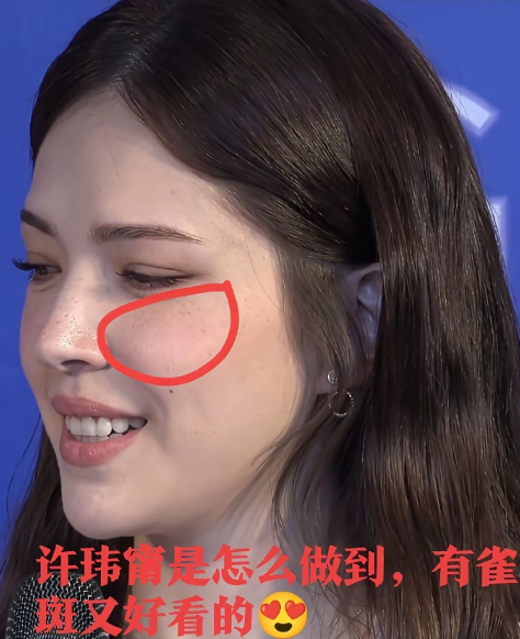 为什么许玮甯一脸雀斑还这么漂亮，她一定很白，长这种斑的人一般都很白！原来漂亮