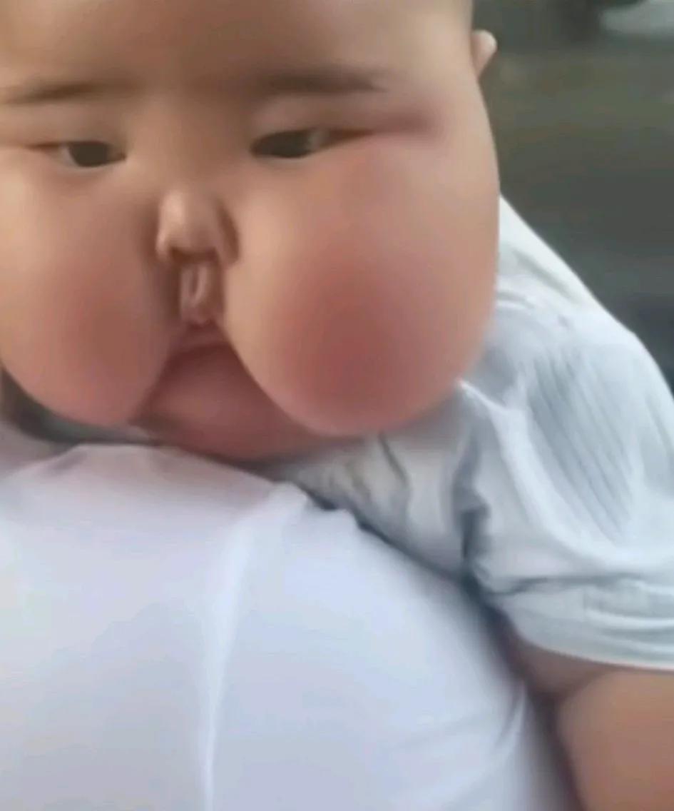 小孩长成这样正常吗？小区里偶遇这样一位小孩，可能有5个月大左右，看着与其他的小朋