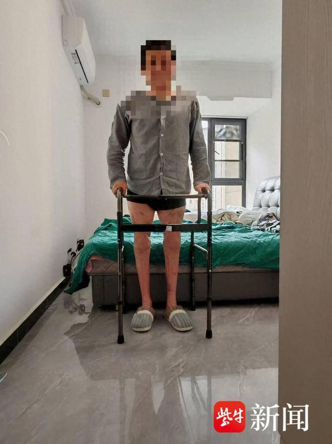 江苏苏州，一工厂内，51岁男子因机器事故导致双大腿完全离断。2024年12月2日