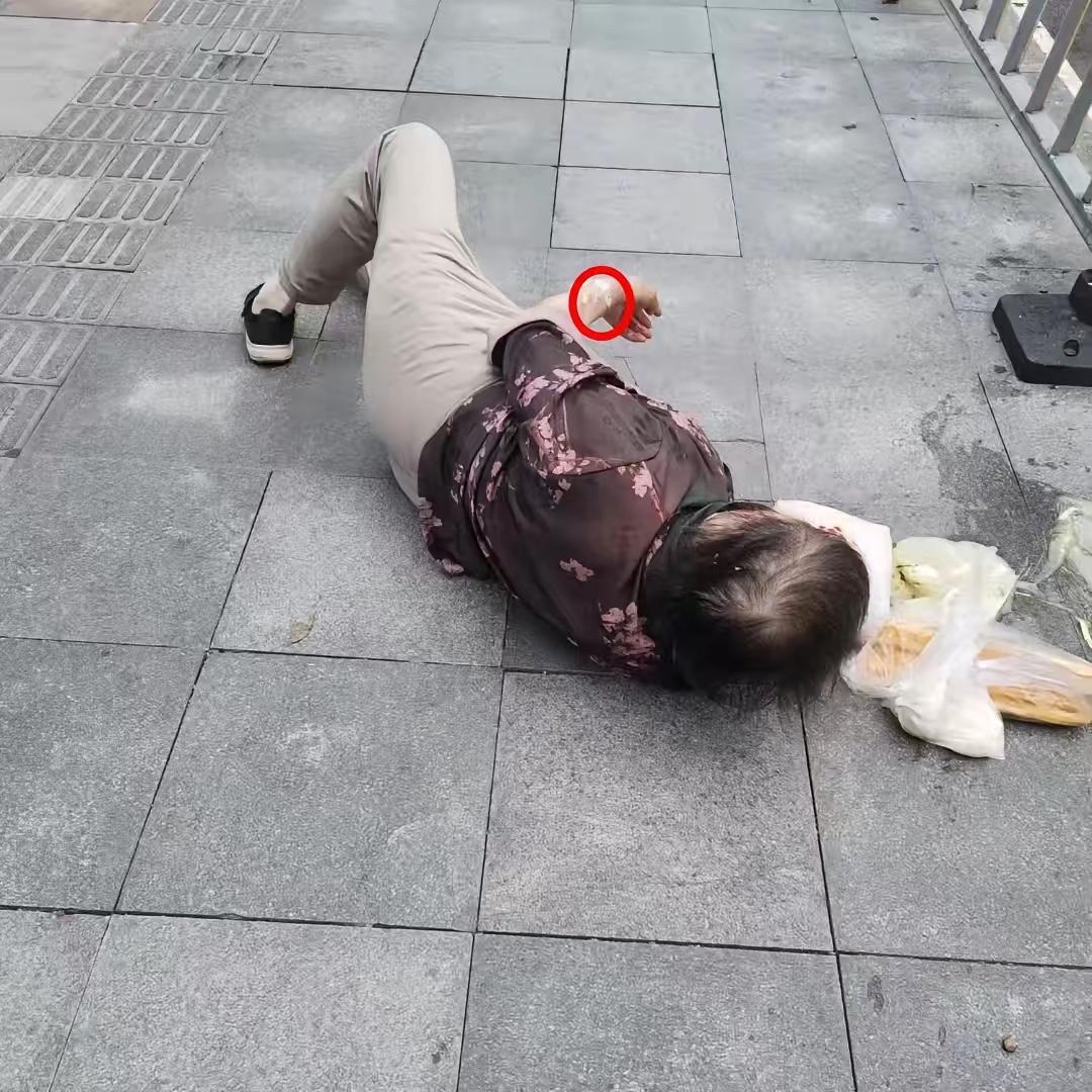 杭州62岁阿姨摔倒躺在路边25分钟，路人不敢上前搀扶，救护车接进急诊，她一口咬定