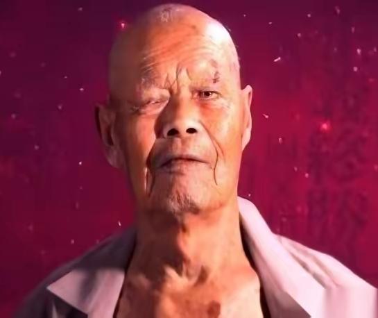 一个山东大哥，硬生生咳了十年。邻居都当他是“痨病鬼”，躲着走。这大哥叫王