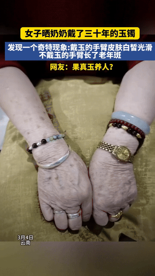 云南，一女子偶然发现，奶奶佩戴了30年玉镯的手臂光滑少斑，而没戴玉镯的手臂老年斑