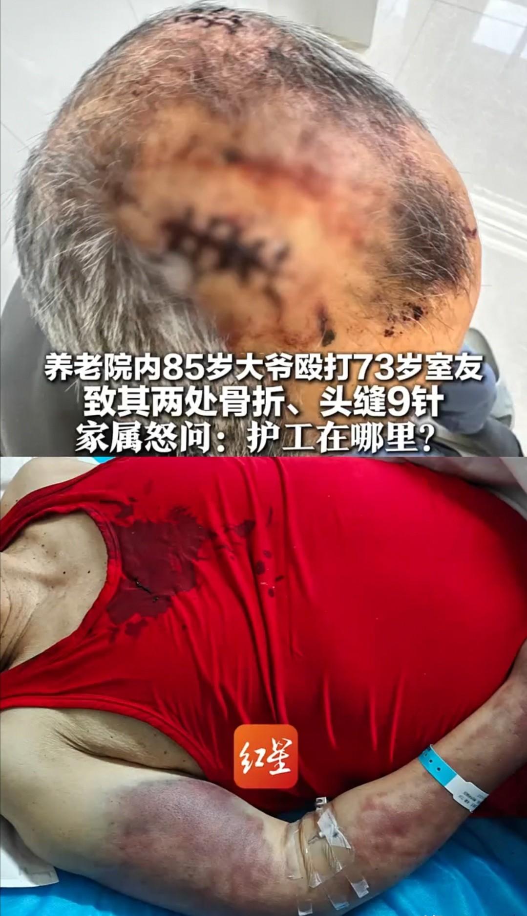 一个73岁的老人，在养老院里被同住的85岁老人从中午12点一直打到下午2点。拖把