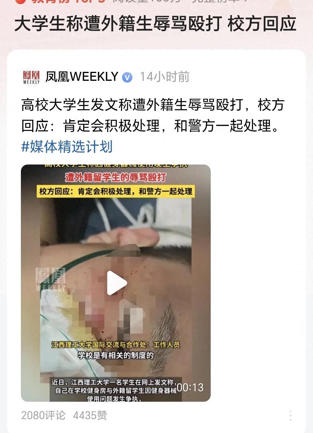 这回江西理工那帮外籍学生可算踢到铁板了，打人时嚣张得鼻孔朝天，现在全蹲局子里等遣返。最讽刺的是这帮人