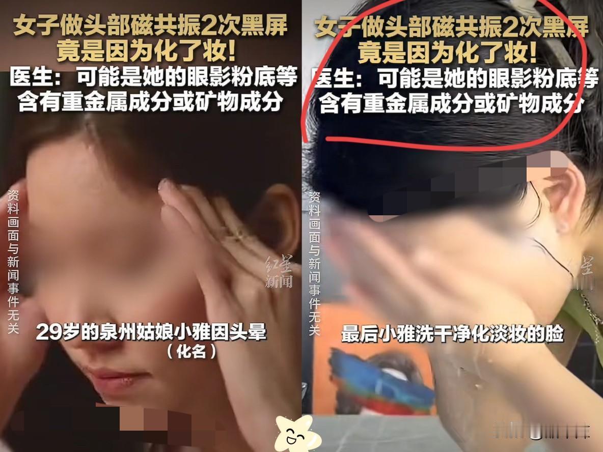 福建一个29岁的姑娘，头晕去做核磁共振，结果机器响了两声就停了。医生连问“戴假牙